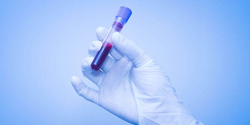 Hepatite C: saiba os riscos e como se prevenir